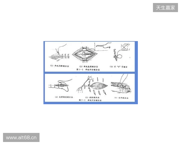 广州豹官方：杨浩眉弓伤口缝合30余针，预计5-7天后拆线